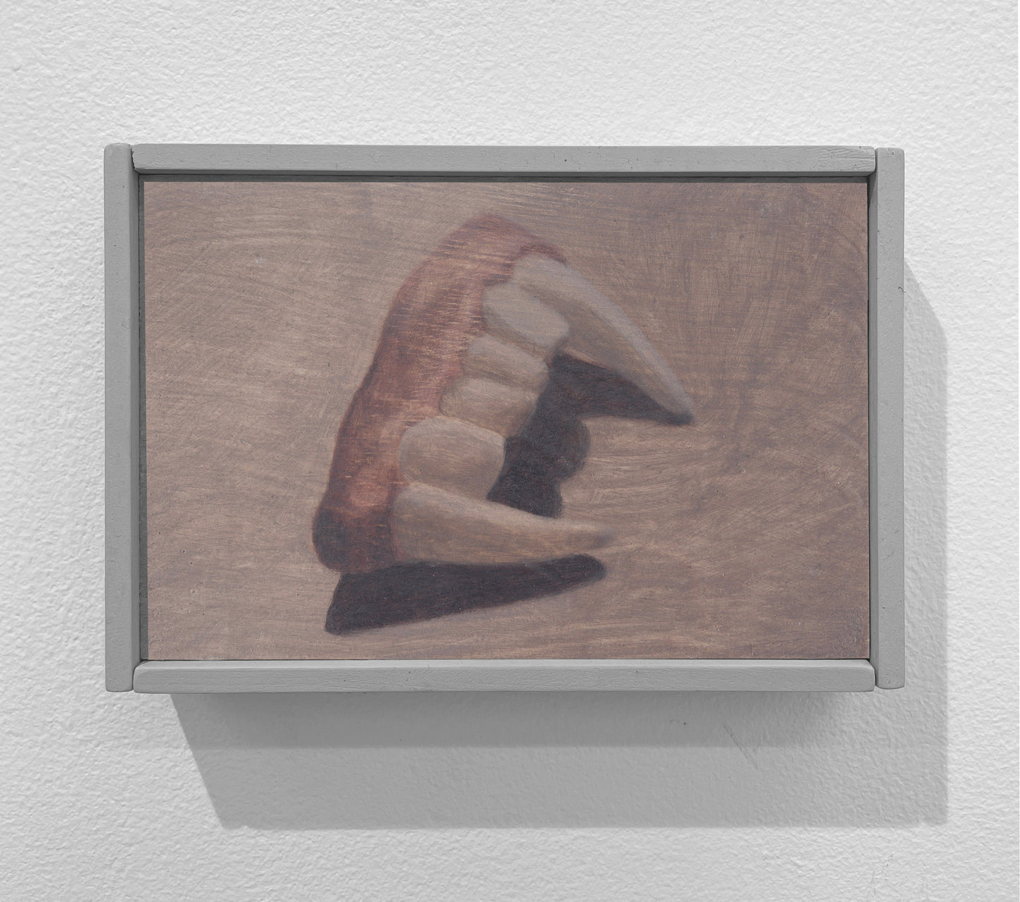 Dents